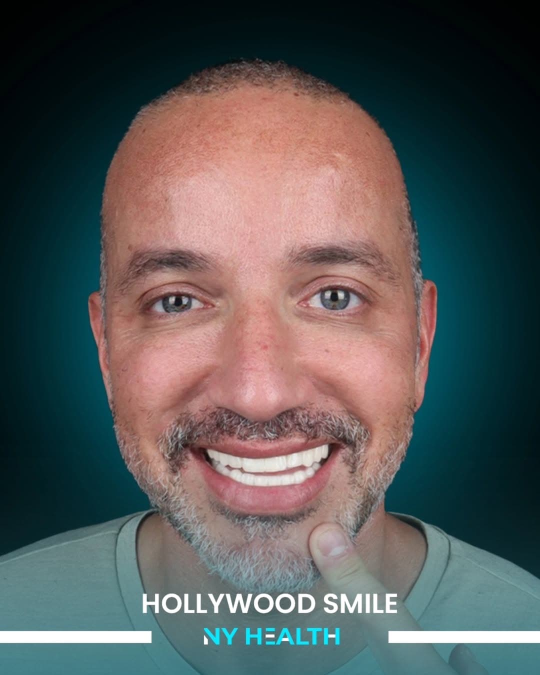 Dental Implant